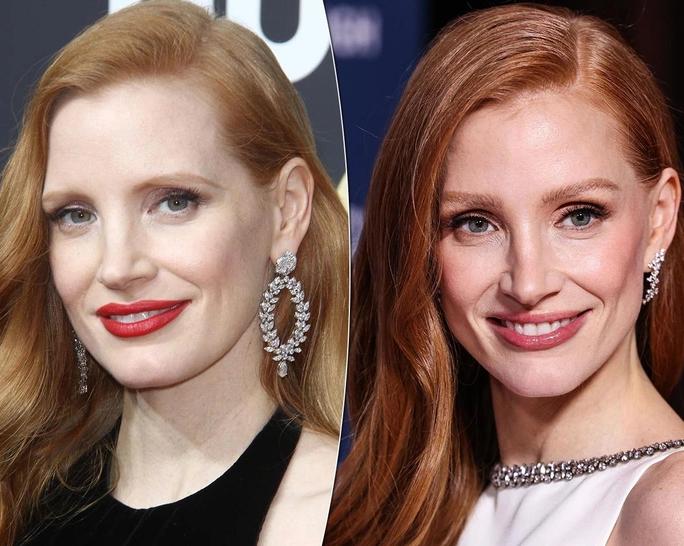 5 звездных примеров идеальной подтяжки лица фото до и после